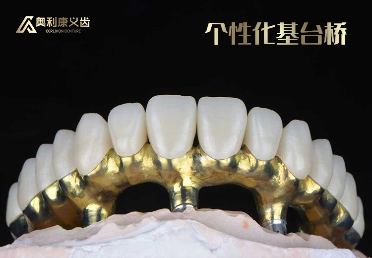 奥利康CAD/CAM个性化基台桥：轻巧定制精准稳固，全口无牙颌修复理想之选