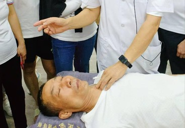 针灸培训