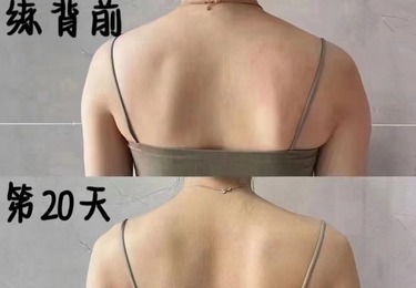 真人案例
