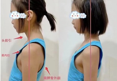 真人案例