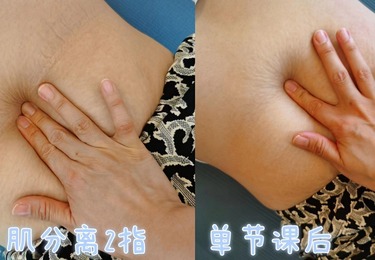 真人案例