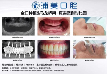 马先生治疗前后对比