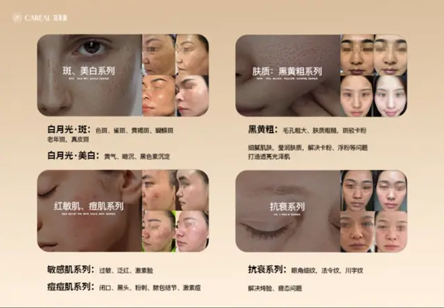 皮肤管理加盟