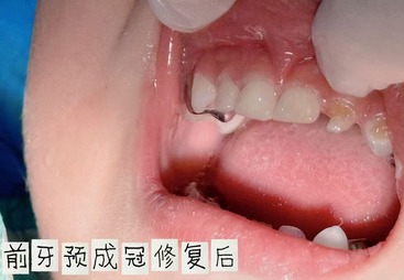 儿童牙科