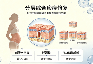 分层综合瘢痕修复